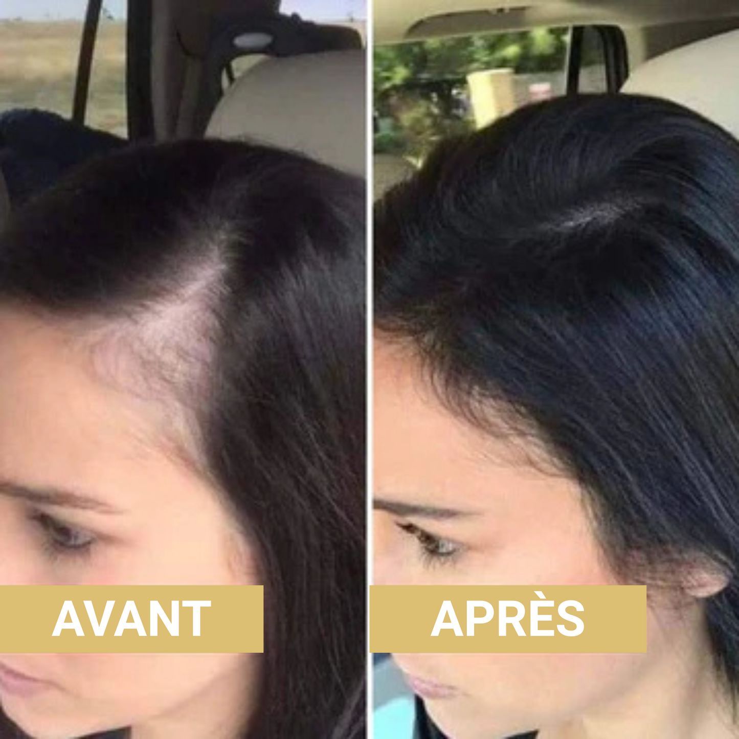 Couvre-Racines Bioxa