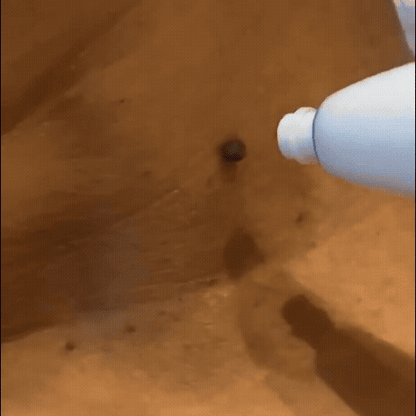 Skinova Labs™ - Dites Adieu aux acrochordons