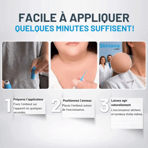 Skinova Labs™ - Dites Adieu aux acrochordons
