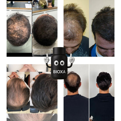 Camouflage Capillaire Bioxa