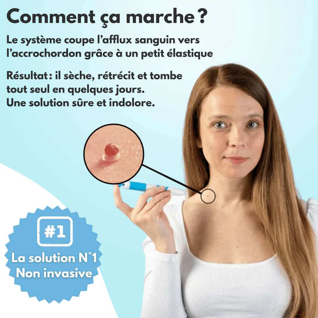 Skinova Labs™ - Dites Adieu aux acrochordons